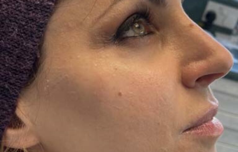 Before - Priyesh Lad Aesthetics