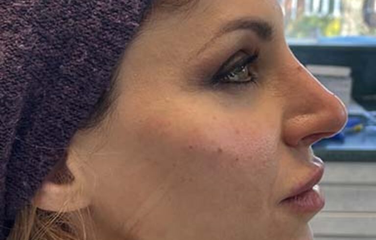 After - Priyesh Lad Aesthetics