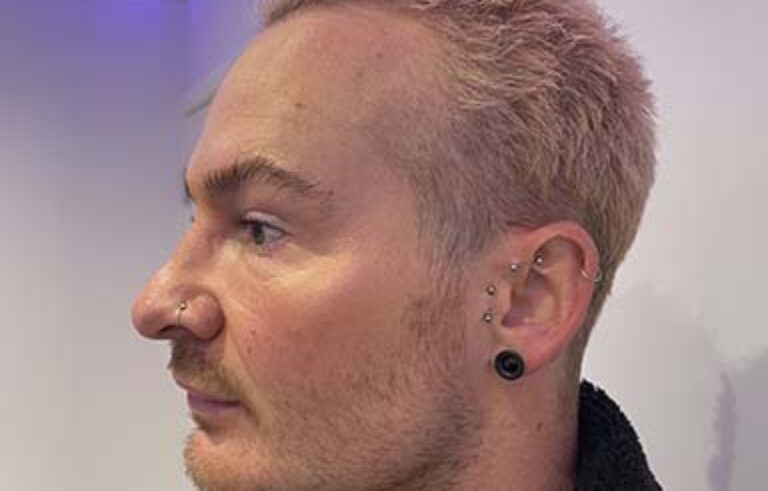 After - Priyesh Lad Aesthetics