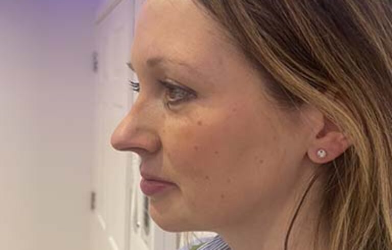 Before - Priyesh Lad Aesthetics