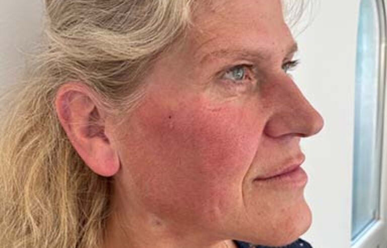 After - Priyesh Lad Aesthetics