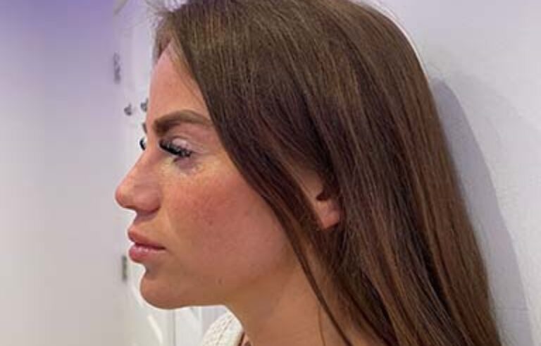 Before - Priyesh Lad Aesthetics