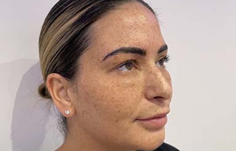 Before - Priyesh Lad Aesthetics