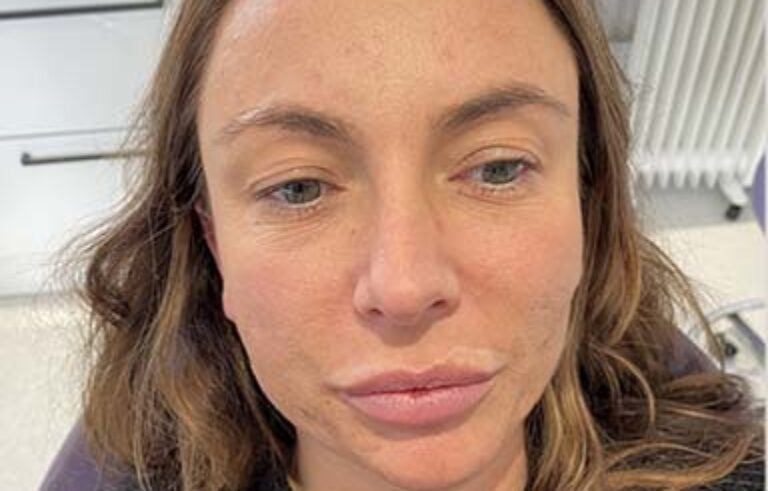 Before - Priyesh Lad Aesthetics