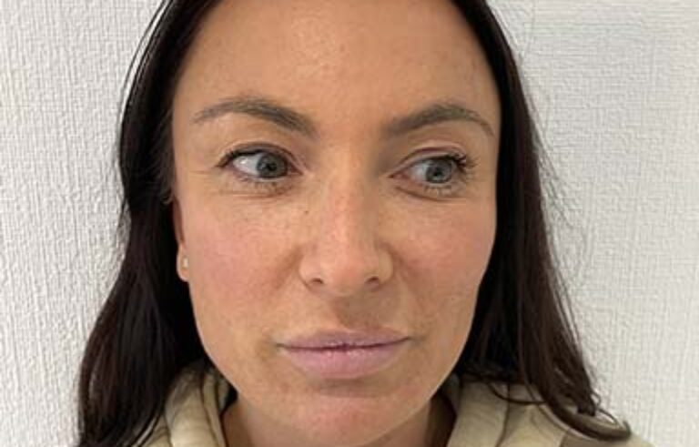 After - Priyesh Lad Aesthetics