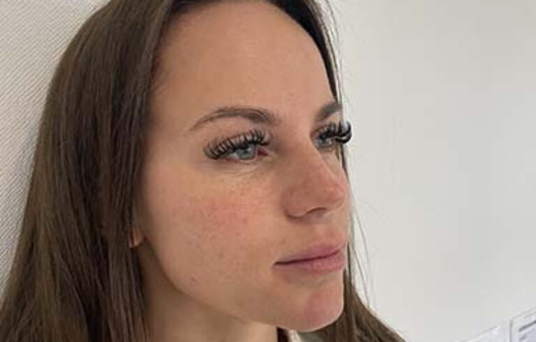 Before - Priyesh Lad Aesthetics