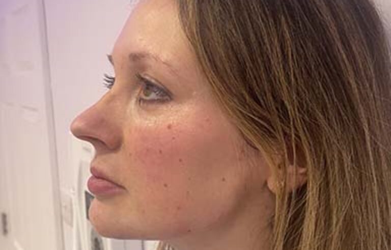 After - Priyesh Lad Aesthetics