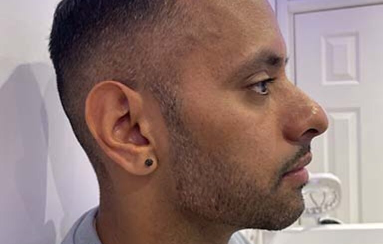 After - Priyesh Lad Aesthetics